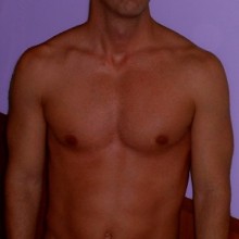 Ver mis fotos