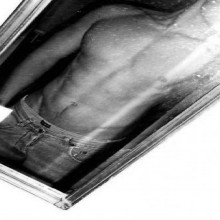 Ver mis fotos